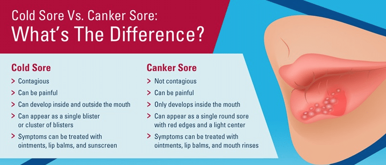 canker sore vs cold sore inside lip